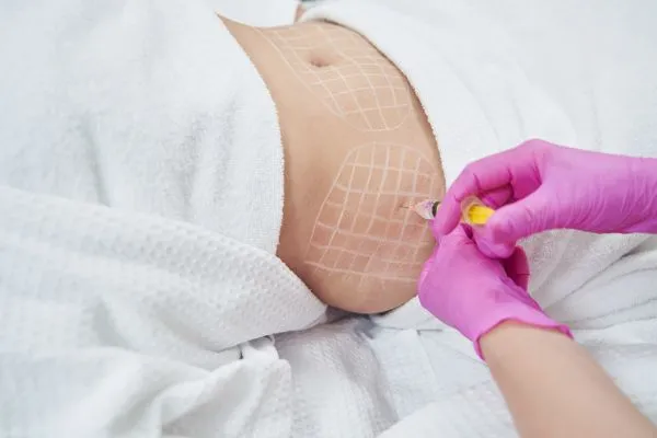 image of fat dissolving injections on love handles to help combat weight gain Great Yarmouth